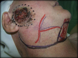 Planificación preoperatoria.