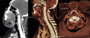 Examples of computed tomography slices and 3D reconstruction.