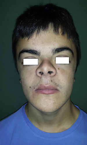 Fotografía facial del paciente.