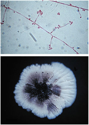 Características macroscópicas y microscópicas de Sporothrix schenckii.