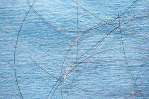 Pelos parasitados en los que se observan las concreciones blanquecinas firmemente adheridas.