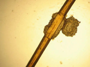 Pelo al microscopio óptico (40×). Obsérvese la estructura hialina que envuelve al pelo y la parasitación ectothrix.
