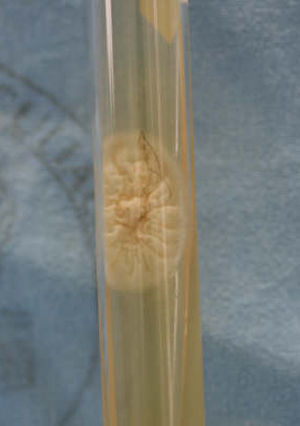 Desarrollo de Trichosporon beigelii en cultivo de pelos en medio de agar Sabouraud. Colonia blanquecina rugosa y cerebriforme.