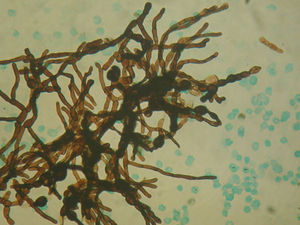 Microphotography of a smear stained by Grocott methenami.