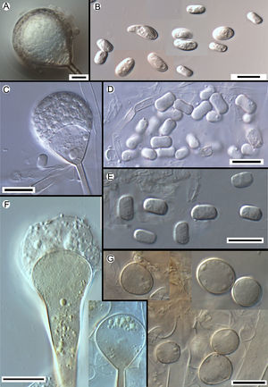 Morphology of the apophyses and sporangiospores of Apophysomyces: (A, B) A. variabilis CBS 658.93 (A, apophyses funnel-shaped; B, sporangiospores). (C, D) A. ossiformis UTHSC 04-838 (C, apophyses funnel-shaped; D, bone-like shaped sporangiospores). (E) A. trapeziformis UTHSC 08-1425 (E, trapezoid-shaped sporangiospores). (F, G) A. elegans CBS 476.78 (F, apophyses bell- and funnel-shaped; (G) subspherical to broadly ellipsoidal sporangiospores). All bars=10μm.