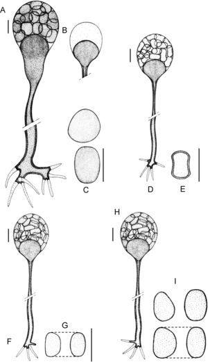 (A)–(C) Apophysomyces elegans (A, vessel-shaped sporangiophore; B, funnel-shaped sporangiophore; C, sporangiospores). (D, E) Apophysomyces ossiformis (D, sporangiophore; E, sporangiospore, frontal and side views). (F, G) Apophysomyces trapeziformis (F, sporangiophore; G, sporangiospore). (H, I) Apophysomyces variabilis (H, sporangiophore; I, sporangiospores). Bars: 10μm.
