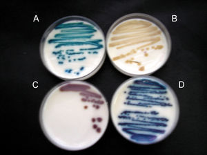 Color y aspecto de las colonias de levaduras en medio Brilliance Candida Agar (Oxoid) A) Candida albicans. B) Candida parapsilosis. C) Saccharomyces cerevisiae. D) Candida tropicalis.