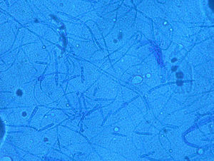 Thick walled multicellular structures. Four months old culture in SDA. Lactophenol–Cotton Blue mount, 400×.