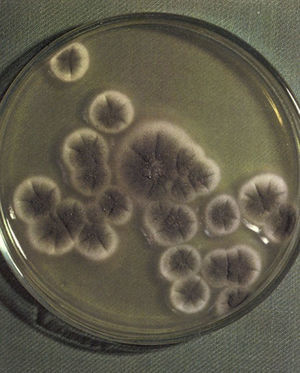 Culture of the clinical sample showing Aspergillus fumigatus colonies.