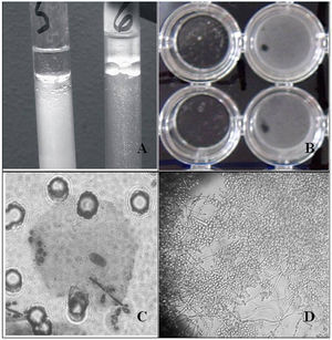 Medida de la HSC (A), adherencia a plástico (B), adherencia a CEB (C) y formación de biocapa (D) en C. albicans ATCC 10231 incubada en RPMI 1640 a 37°C.