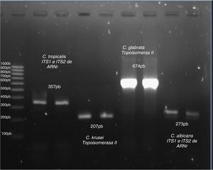 Amplificación de ADN de C. tropicalis, C. krusei, C. glabrata y C. albicans. Carril 1: marcador de pares de bases (Mpb) pBR322 digerido con HaeIII (Sigma, EE.UU.).