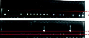 Geles de agarosa al 1,5% para la identificación de C. albicans y C. glabrata, aislamientos 1 a 50. Línea 1: C. glabrata (674 pb); línea 2: C. albicans (273 pb); carril 1: marcador de pares de bases (Mpb) pBR322 digerido con HaeIII (Sigma, EE.UU.).