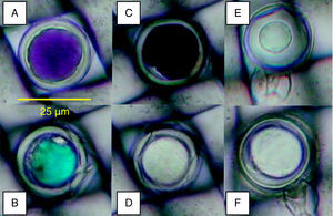Oospores were embedded in 25-μm-pore nylon mesh. Staining colours (A: red to rose; B: blue; C: black; D: unstained) obtained with the tetrazolium bromide (MTT) test (24h, 35°C, 0.1% MTT solution) and viable (E: plasmolized) or unviable (F: non-plasmolized) oospores with the plasmolysis method (45minutes, 4mol l−1 sodium chloride solution).