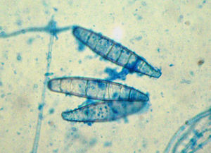 Examen microscópico de las colonias, azul lactofenol, x1.000.