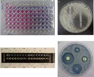 Métodos comercializados para el estudio de la actividad in vitro de los antifúngicos: Sensititre Yeast One (a), Etest (b), ATBFungus (c) y difusión en disco con tabletas NeoSensitabs (d).