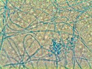 . Imagen en microscopio óptico de hifas septadas, verticilo y células conidiógenas de Beauveria bassiana, con tinción de azul de lactofenol (x 60)