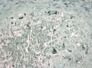 Histopathological examination with Grocott's stain (magnification ×400).
