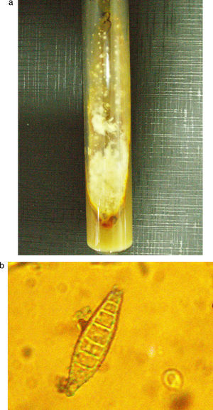 Aspecto macromorfológico (a) y micromorfológico (b) de las colonias del microorganismo aislado.