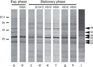 Western blot of protein extracts from: (a) exponential phase cells; (b) exponential phase cells incubated for 2h at 37°C in the SDB in which cells had been growing; (c) stationary phase cells; (d) stationary phase cells incubated for 2h at 24°C in fresh SDB; (e and f) stationary phase cells incubated for 15min or 2h at 37°C in fresh SDB, respectively; (g and h) stationary phase cells incubated for 15min or 2h at 37°C in SDB without peptone, respectively; and (i) mannoprotein detection using concanavalin A in stationary phase cells incubated for 2h at 37°C in fresh SDB.