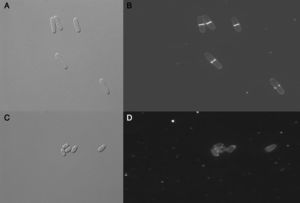 Schizosaccharomyces pombe morphology after treatment with altenusin. A: Differential interphase contrast (DIC) micrographs of S. pombe cells in the absence of altenusin; B: Fluorescence micrographs of S. pombe stained with calcofluor white in the absence of altenusin; C: S. pombe DIC in the presence of altenusin (31.2μg/ml); D: S. pombe stained with calcofluor white in the presence of altenusin (31.2μg/ml).