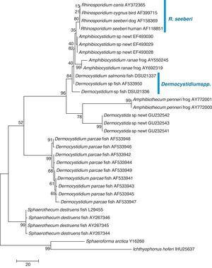Parsimony tree aligned 18S SSU rDNA sequences of four R. seeberi and 28 other dermocystidian DNA sequences. The ichthyosporeans Sphaeroforma artica and Ichthyophonus hoferi were used as outgroup. Numbers above the branches are percentages of 1000 bootstrap-resampled data sets. The scale bar represents substitutions per nucleotide. The accession numbers are located after the organism's name. In this phylogenetic tree the four R. seeberi DNA sequences formed a well supported sister taxon to the five Amphibiocystidium spp. DNA sequences from newts and frogs. The three Dermocystidium species DNA sequences in turn formed a poor supported sister taxon to Amphibiocystidium and Rhinosporidium. The phylogenetic analysis indicates that Rhinosporidium seeberi shares more phylogenetic features in common with Amphibiocytidium than to the other members of the Dermocystida. Several strains of Dermocystidium percae were placed in a strongly supported taxon indicating that this pathogen of fish probably is not a Dermocystidium species. The genus Dermotheca has been suggested by some to differentiate this pathogen of fish from the other Dermocystidium species.