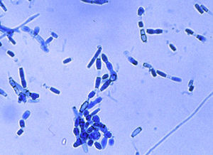 Examen microscópico del cultivo. Preparación por disociación montada en azul de lactofenol (×400).