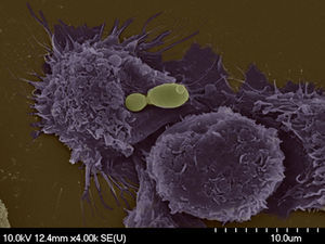 Scanning electron microscopy of C. parapsilosis interacting with murine macrophages (photo credit to T. Németh, T. Petkovits, and A. Gácser).
