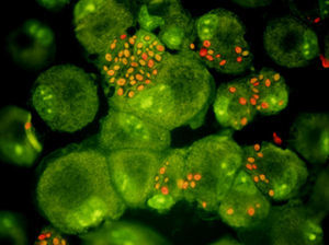 Immunofluorescence microscopy of C. parapsilosis and human macrophages. Red yeast are dead (photo credit to C. Papp and A. Gácser).