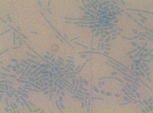 Artroconidias sin blastoconidias de Geotrichum candidum.