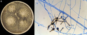 Morphological examination of A. infectoria. (a) Macroscopic appearance of cultured A. infectoria with its typical grey-olivaceous colour and felty-woolly texture. (b) Microscopic appearance of A. infectoria (CLFMC 16433). Conidiophores and a conidial chain.