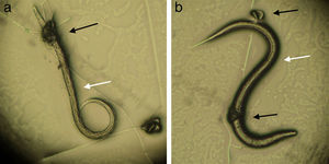 Formation of trap (black arrow) by the tested fungal isolate of Duddingtonia flagrans (CG768) and third stage larvae of Ancylostoma spp. preyed (white arrow).
