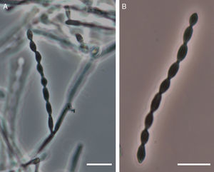 Aspecto microscópico de la colonia de C. bantiana a los 8 días de incubación en agar glucosado de Sabouraud-cloranfenicol (×400). A) Conidióforo. B) Cadena de conidias.