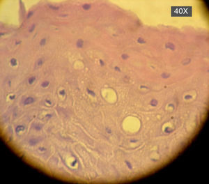 Observación de tejido gingival con tinción de hematoxilina-eosina en un paciente sano.