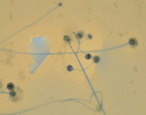 Rhizomucor pusillus. Visualización microscópica en fresco con Azul de lactofenol (×100): microfotografía de hifas que se dividen en ángulos mayores de 45° y estructuras de fructificación (esporangios con esporangiosporas).