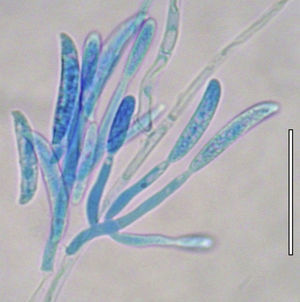 Conidioforos y macroconidios de Fusarium solani (lactofenol-azul de algodón) (barra=40μm).