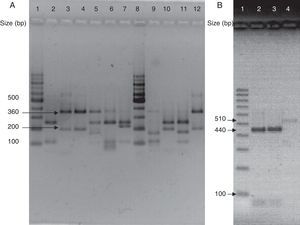(A) Visualization of 26S rDNA products after digestion with Cfo I (Lane 1–12: 100bp ladder, CBS 7019 M. furfur, CBS 7222 M. sympodialis, CBS 9169 M. dermatis, CBS 9558 M. nana, CBS 7956 M. slooffiae, CBS 10533 M. pachydermatis, 100bp ladder, CBS 9725 M. yamatoensis, CBS 9432 M. japonica, CBS 7876 M. obtusa, and IMR-M-735). (B) Digestion with Mbo I (Lanes 1–4: 100bp ladder, IMR-M-735, CBS 7222 M. sympodialis and CBS 9169 M. dermatis).