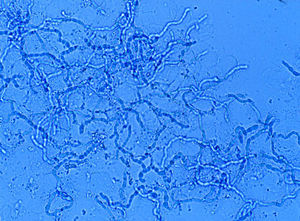 Abundantes hifas hialinas, septadas y ramificadas observadas en examen directo de un paciente afectado de tinea cruris (KOH, 40×).