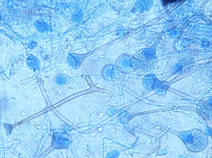 Lactophenol-cotton blue (LCB) mount of a culture of Apophysomyces variabilis (400×).