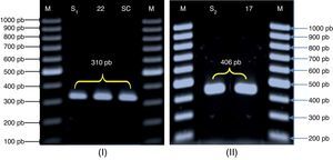 Agarose gel electrophoresis (1% agarose) of the amplification products obtained for the RPS0 gene. M: molecular weight marker (100-pb DNA ladder, Fermentas, Madrid, Spain). (I): C. albicans strains. (II): C. glabrata strains; S1’: C. albicans ATCC 90028; S2: C. glabrata ATCC 90030; SC: C. albicans SC5314; 22 and 17: vaginal C. albicans and C. glabrata strains, respectively.