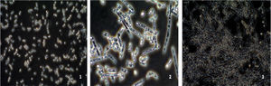 Microscopic observation of the filamentation range of C. albicans strains on Lee medium (×40). (1): C. albicans strain (non-filamentation producer) (strain 7); (2): C. albicans strain (moderate-filamentation producer) (type strain ATCC 90028) and (3): C. albicans strain (strong-filamentation producer) (strain 24).