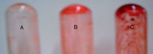 Slime production range of vaginal Candida strains on glass tubes stained with 1% safranin. (a) Weak slime production (C. glabrata: strain 12); (b) moderate slime production (C. albicans: strain 3); (c) strong slime production (C. albicans SC 5314).
