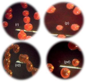 Morphotypes of Candida strains based on the colorimetric scale obtained on Congo red agar: (p), pink colonies; (pd), pink colonies with a darkening at the center; (r): red; (rd): red colonies with a darkening at the center. (For interpretation of the references to color in this figure legend, the reader is referred to the web version of this article.)