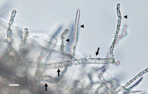 The figure depicts the development of articulate and disarticulated sporangia (arrows) of Lagenidium ajelloi on a grass blade in induction medium showing the formation of slender discharge tubes (arrow heads). The development of exit tubes from elongate sporangia (arrow heads) gives rise to vesicles at the tip of the each exit tube, as shown in Fig. 3 (Bar=40μm). L. albertoi and L. vilelae developed also similar sporangia structures in induction medium before zoospore formation.