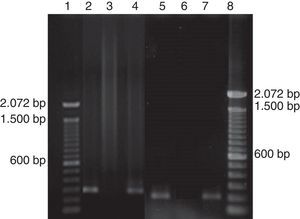 Representative nested PCR. Lanes 1 and 8: Molecular marker DNA ladder, 100bp (Invitrogen); Lanes 2 and 4: P. jirovecii; Lanes 5 and 7: H. capsulatum; Lanes 3 and 6: Negative controls.