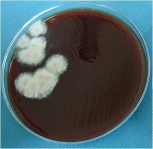 Primary isolation showing several white to tan, cottony fungal colonies on blood agar after 8 days of incubation.