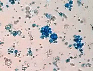 Examen microscópico del cultivo en BHI-agar a 37°C con azul lactofenol (×200). Se observan levaduras multibrotantes, en forma de rueda de timón.