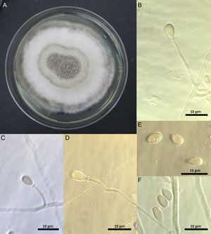 (A–D) Scedosporium dehoogii, ChFC 151. (A) Colony growing on PDA after 14 days at 25°C. (B–D) Conidiogenous cells and conidia. (E, F) Conidia.