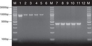 Detection of genes encoding HWP1 protein and the ITS region, by PCR method among selected C. albicans and C. glabrata isolates from ICU. Lane M: 100-bp molecular size marker (Thermo Fisher Scientific, Waltham, Massachusetts, USA); lane 1: C. albicans ATCC 90028; clinical C. albicans strains in lane 2: CA1; lane 3: CA22; lane 4: CA39; lane 5: CA48. Lane 7: C. glabrata ATCC 2001; clinical C. glabrata strains in lane 8: CG1; lane 9: CG12; lane 10: CG24; lane 11: CG31. Lanes 6 and 12: negative controls.