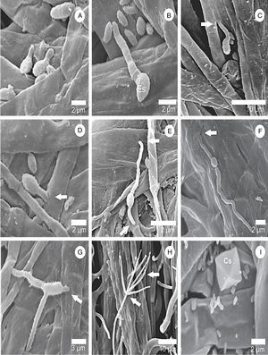 Surface scanning electron micrographs showing the process of germination and infection of L. fungicola in fruiting bodies of A. bisporus. (A and B) Spore germination of L. fungicola on A. bisporus hyphae; (C–G) arrows indicate the point of infection of L. fungicola in A. bisporus tissue with emission of one germ tube in (C–D), two germ tubes in (E–F) and three germ tubes in G; (H) formation of L. fungicola conidiophores whorls and phialides in verticils; (I) presence of calcium oxalate crystals (Cs).