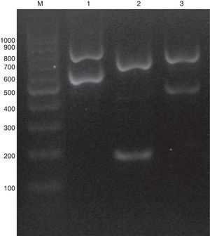 Electrophoresis of the multiplex PCR. Lane M, 100-bp molecular size marker; lane 1, C. glabrata sensu stricto; lane 2, C. nivariensis; lane 3, C. bracarensis.